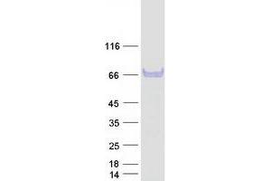 Validation with Western Blot
