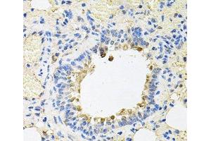 Immunohistochemistry of paraffin-embedded Rat lung using SKAP2 Polyclonal Antibody at dilution of 1:100 (40x lens).