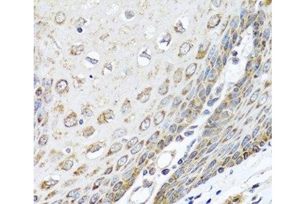 DEDD antibody