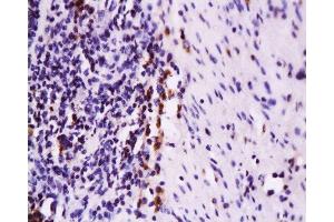 Formalin-fixed and paraffin embedded rat colon tissue labeled with Anti-Fas Polyclonal Antibody, Unconjugated  at 1:200 followed by conjugation to the secondary antibody and DAB staining (FAS antibody  (AA 35-110))