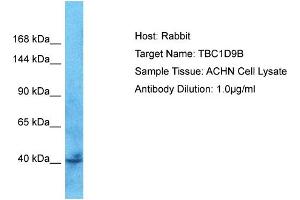 Host: Rabbit Target Name: TBC1D9B Sample Tissue: Human ACHN Whole Cell  Antibody Dilution: 1ug/ml (TBC1D9B antibody  (C-Term))