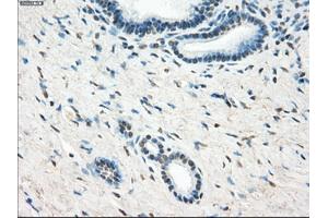 Immunohistochemical staining of paraffin-embedded Ovary tissue using anti-LTA4H mouse monoclonal antibody. (LTA4H antibody)