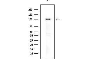 anti-Discs, Large Homolog 2 (DLG2) (pTyr340) antibody