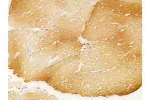 ABIN6265804 and ABIN6266666 at 1/100 staining human normal gastric tissue by IHC-P. (gamma Tubulin antibody  (N-Term))