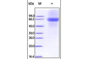 SDS-PAGE (SDS) image for Interleukin 12 alpha (IL12A) (AA 23-219) protein (Fc Tag) (ABIN2181329) (IL12A Protein (AA 23-219) (Fc Tag))