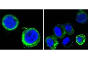 Confocal immunofluorescence analysis of methanol-fixed HEK293 cells trasfected with AXL-hIgGFc using AXL mouse mAb(green), showing cytoplasmic and membrane localization. (AXL antibody)