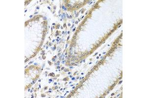Immunohistochemistry (Paraffin-embedded Sections) (IHC (p)) image for anti-Eukaryotic Translation Initiation Factor 4E (EIF4E) (AA 1-100) antibody (ABIN3023085)