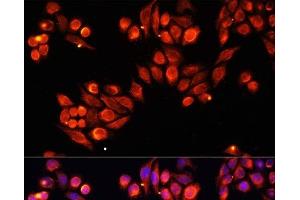 Immunofluorescence analysis of HeLa cells using Heparanase 1 Polyclonal Antibody at dilution of 1:100. (HPSE antibody)