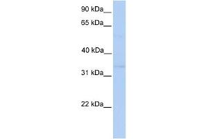 WB Suggested Anti-NDE1 Antibody Titration: 0. (NDE1 antibody  (Middle Region))