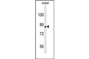 Western blot analysis of KIAA1680 Antibody (C-term) in Jurkat cell line lysates (35ug/lane). (MGC48628 (AA 787-816), (C-Term) antibody)