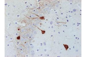 Immunostaining of paraffin embedded section of mouse brain (dilution 1 : 500). (PVALB antibody)