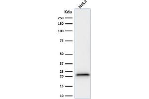 Western Blot Analysis of human HeLa cell lysate using p21 Mouse Recombinant Monoclonal Antibody (rCIP1/823). (Recombinant p21 antibody)