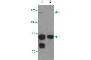Western blot analysis of CCDC141 in SK-N-SH cell lysate with CCDC141 polyclonal antibody  at 1 ug/mL in (1) the absence and (2) the presence of blocking peptide. (CCDC141 antibody  (N-Term))