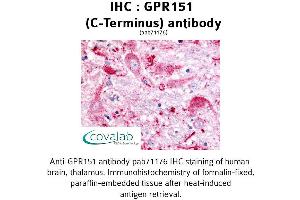 Image no. 1 for anti-G Protein-Coupled Receptor 151 (GPR151) (C-Term) antibody (ABIN1734966) (GPR151 antibody  (C-Term))