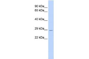 WB Suggested Anti-TRIM55 Antibody Titration:  0. (TRIM55 antibody  (Middle Region))
