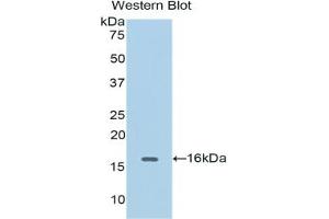 Detection of Recombinant CDK1, Human using Polyclonal Antibody to Cyclin Dependent Kinase 1 (CDK1) (CDK1 antibody  (AA 59-182))
