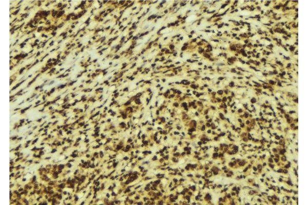 HMGN2 antibody  (Internal Region)