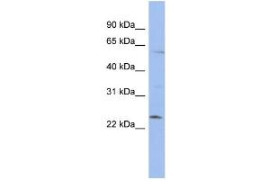 WB Suggested Anti-ZNF239 Antibody Titration:  0. (ZNF239 antibody  (N-Term))