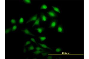 Immunofluorescence of monoclonal antibody to NME1 on HeLa cell. (NME1 antibody  (AA 1-152))