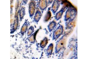 Used in DAB staining on fromalin fixed paraffin-embedded Intestine tissue (GDF15 antibody  (AA 30-308))