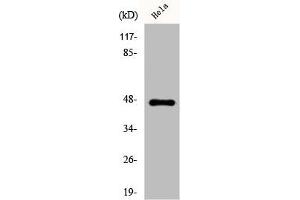 Western Blot analysis of HeLa cells using Cytokeratin 20 Polyclonal Antibody (Keratin 2 antibody  (C-Term))