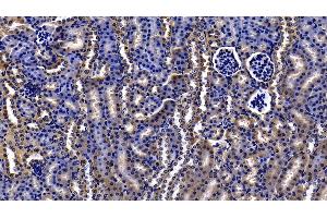 Detection of ORM2 in Mouse Kidney Tissue using Polyclonal Antibody to Orosomucoid 2 (ORM2) (Orosomucoid 2 antibody  (AA 19-207))
