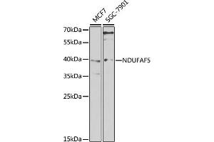 Western blot analysis of extracts of various cell lines, using NDUF antibody (ABIN6128985, ABIN6144470, ABIN6144471 and ABIN6222949) at 1:1000 dilution. (C20orf7 antibody  (AA 196-345))