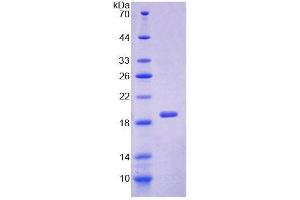 SDS-PAGE (SDS) image for Sorcin (SRI) (AA 29-169) protein (His tag) (ABIN4990659) (SRI Protein (AA 29-169) (His tag))