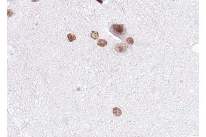 ABIN6267530 at 1/100 staining human brain tissue sections by IHC-P. (MAP2K4 antibody  (pSer80))