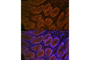 Immunofluorescence analysis of rat rectum cells using CE Rabbit mAb (ABIN7266085) at dilution of 1:100 (40x lens). (CEACAM6 antibody)
