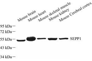 Western blot analysis of SELP-M (ABIN7075533) at dilution of 1: 1000 (Selenoprotein P antibody)