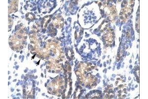 Image no. 1 for anti-Proteasome (Prosome, Macropain) 26S Subunit, ATPase, 3 (PSMC3) (AA 293-339) antibody (ABIN202439) (PSMC3 antibody  (AA 293-339))
