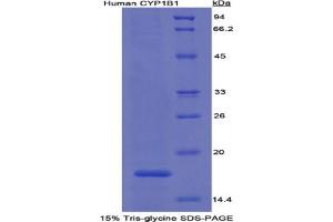 SDS-PAGE analysis of Human Cytochrome P450 1B1 Protein. (CYP1B1 Protein)