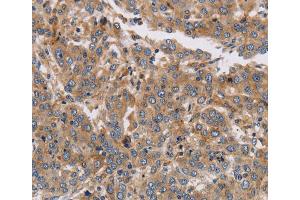 Immunohistochemistry (IHC) image for anti-Potassium Voltage-Gated Channel, Subfamily G, Member 1 (KCNG1) antibody (ABIN5549987) (KCNG1 antibody)