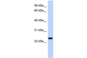 WB Suggested Anti-NKAIN4 Antibody Titration: 0. (NKAIN4 antibody  (N-Term))