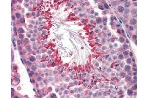 IHC Image for AP22588PU-N Mouse Testis (formalin-fixed, paraffin-embedded) stained with M6PRBP1followed by biotinylated anti-goat IgG secondary antibody LS-D3, alkaline phosphatase-streptavidin and chromogen. (PLIN3 antibody  (Internal Region))