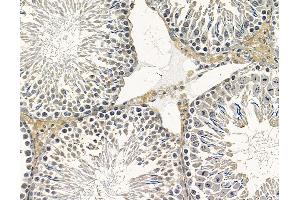 DERA Antibody at 1/100 staining rat testis tissue by IHC-P.