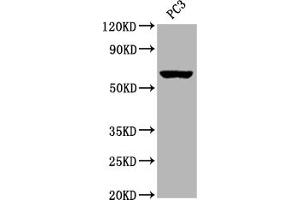 Western Blot Positive WB detected in:PC3 whole cell lysate All lanes: Muscarinic Acetylcholine Receptor M3 antibody at 1:2000 Secondary Goat polyclonal to rabbit IgG at 1/50000 dilution Predicted band size: 67 kDa Observed band size: 67 kDa (Recombinant CHRM3 antibody)