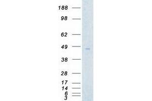 Validation with Western Blot