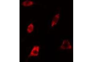 ABIN6278624 staining 293 cells by IF/ICC. (RAB35 antibody  (Internal Region))