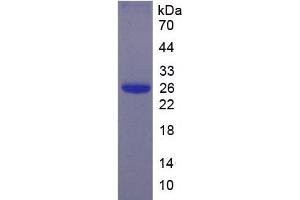SDS-PAGE of Protein Standard from the Kit (Highly purified E. (EBI3 CLIA Kit)