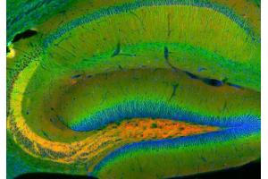 Indirect immunohistochemistry of a rat hippocampus section with rabbit anti-amphiphysin (cat. (Amphiphysin antibody  (AA 2-15))
