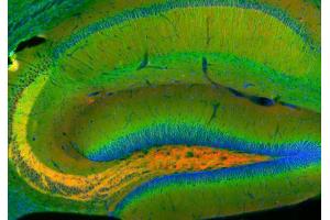 Indirect immunohistochemistry of a rat hippocampus section with rabbit anti-amphiphysin (cat. (Amphiphysin antibody  (AA 2-15))