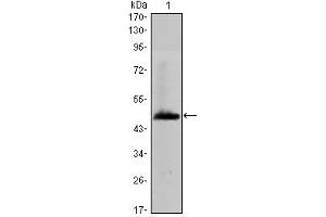 Western Blot showing HAS1 antibody used against human HAS1 (AA: 74-243) recombinant protein. (HAS1 antibody)