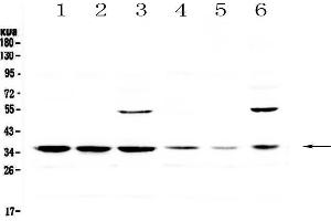 Western blot analysis of JunD using anti-JunD antibody .