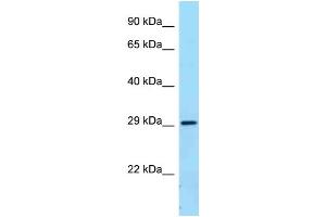 WB Suggested Anti-FCGR2B Antibody Titration: 1.