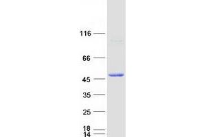 Western Blotting (WB) image for serpin Peptidase Inhibitor, Clade B (Ovalbumin), Member 13 (SERPINB13) protein (Myc-DYKDDDDK Tag) (ABIN2731765)