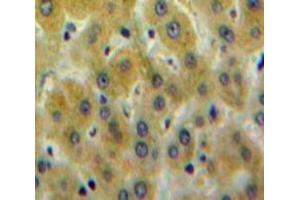 Used in DAB staining on fromalin fixed paraffin-embedded Liver tissue (PLEKHA1 antibody  (AA 92-346))