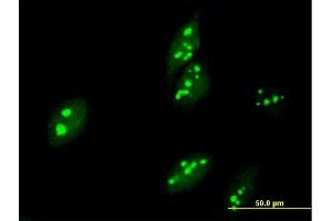 Immunofluorescence of purified MaxPab antibody to ABT1 on HeLa cell.