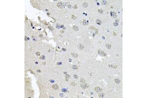 Immunohistochemistry of paraffin-embedded mouse brain using PKN1 antibody. (PKN1 antibody)